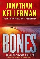 Bones